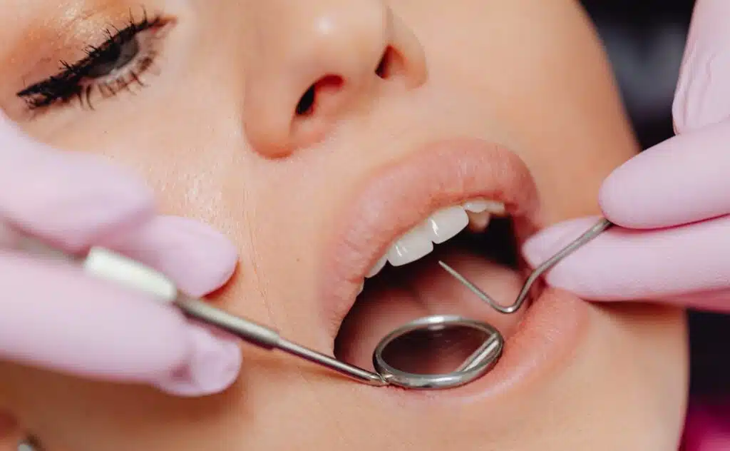 salud dental-joven-reparando sus dientes